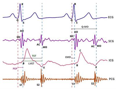 Comparison of Different Methods for Estimating Cardiac Timings: A Comprehensive Multimodal Echocardiography Investigation